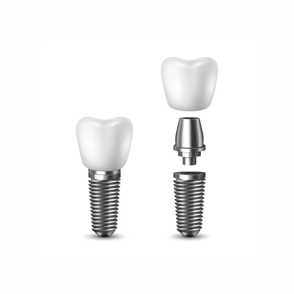 dental implants glendale az | single tooth implant