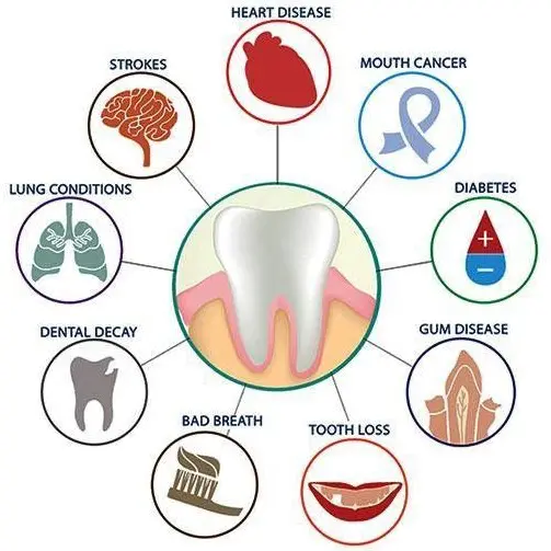 periodontist glendale az | graphic depicting the affects of periodontitis