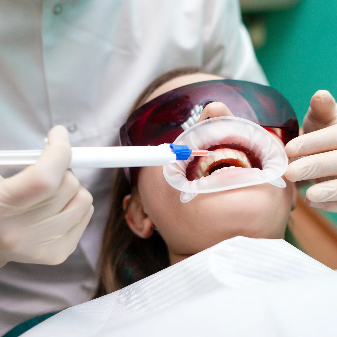 dentist applying teeth whitening gel to patient | teeth whitening glendale az